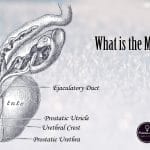 what is the male g-spot?
